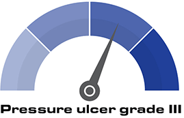 Pressure Ulcer Grade III